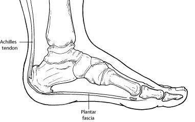 causes of heel pain